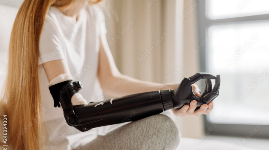 Upper-limb-Prosthetic